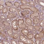 PARP3 Antibody in Immunohistochemistry (Paraffin) (IHC (P))