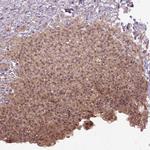 PARP3 Antibody in Immunohistochemistry (Paraffin) (IHC (P))