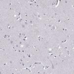 MIP-3 beta Antibody in Immunohistochemistry (Paraffin) (IHC (P))