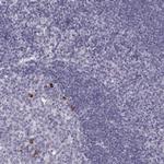 MIP-3 beta Antibody in Immunohistochemistry (Paraffin) (IHC (P))