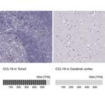 MIP-3 beta Antibody