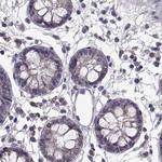 ADH6 Antibody in Immunohistochemistry (Paraffin) (IHC (P))