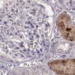 ADH6 Antibody in Immunohistochemistry (Paraffin) (IHC (P))