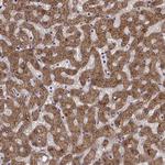 ADH6 Antibody in Immunohistochemistry (Paraffin) (IHC (P))