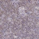 ADH6 Antibody in Immunohistochemistry (Paraffin) (IHC (P))