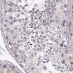 ADH6 Antibody in Immunohistochemistry (Paraffin) (IHC (P))