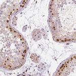 ERF Antibody in Immunohistochemistry (Paraffin) (IHC (P))