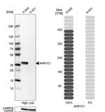 AKR1C1 Antibody