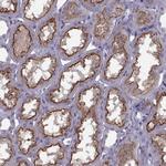 CACNA1F Antibody in Immunohistochemistry (Paraffin) (IHC (P))