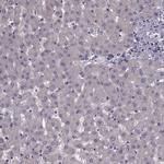 CACNA1F Antibody in Immunohistochemistry (Paraffin) (IHC (P))