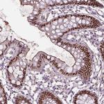 SOX17 Antibody in Immunohistochemistry (Paraffin) (IHC (P))