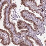 SOX17 Antibody in Immunohistochemistry (Paraffin) (IHC (P))