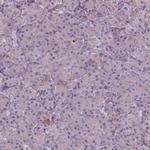 SOX17 Antibody in Immunohistochemistry (Paraffin) (IHC (P))