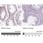 PIAS2 Antibody