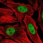 PIAS2 Antibody in Immunocytochemistry (ICC/IF)