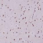 PIAS2 Antibody in Immunohistochemistry (Paraffin) (IHC (P))