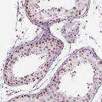 PIAS2 Antibody in Immunohistochemistry (Paraffin) (IHC (P))