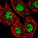 MED25 Antibody in Immunocytochemistry (ICC/IF)