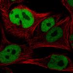 SOX10 Antibody in Immunocytochemistry (ICC/IF)