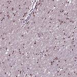 SOX10 Antibody in Immunohistochemistry (Paraffin) (IHC (P))