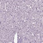 SOX10 Antibody in Immunohistochemistry (Paraffin) (IHC (P))