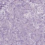 SOX10 Antibody in Immunohistochemistry (Paraffin) (IHC (P))