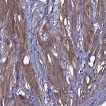 ITGB1 Antibody in Immunohistochemistry (Paraffin) (IHC (P))