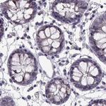 ADH6 Antibody in Immunohistochemistry (Paraffin) (IHC (P))