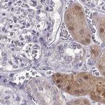 ADH6 Antibody in Immunohistochemistry (Paraffin) (IHC (P))