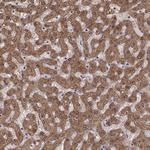 ADH6 Antibody in Immunohistochemistry (Paraffin) (IHC (P))