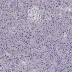 ADH6 Antibody in Immunohistochemistry (Paraffin) (IHC (P))