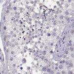 ADH6 Antibody in Immunohistochemistry (Paraffin) (IHC (P))