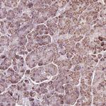 LFNG Antibody in Immunohistochemistry (Paraffin) (IHC (P))