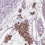 LFNG Antibody in Immunohistochemistry (Paraffin) (IHC (P))