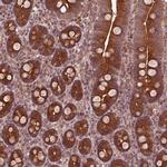 PIK3R2 Antibody in Immunohistochemistry (Paraffin) (IHC (P))