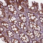 MARCKS Antibody in Immunohistochemistry (Paraffin) (IHC (P))