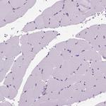 MARCKS Antibody in Immunohistochemistry (Paraffin) (IHC (P))