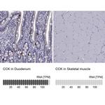 CCK Antibody