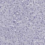 CCK Antibody in Immunohistochemistry (Paraffin) (IHC (P))