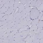 CCK Antibody in Immunohistochemistry (Paraffin) (IHC (P))