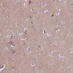 Tau Antibody in Immunohistochemistry (Paraffin) (IHC (P))