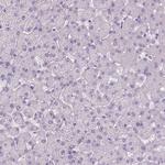 Tau Antibody in Immunohistochemistry (Paraffin) (IHC (P))