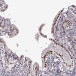 KLF6 Antibody in Immunohistochemistry (Paraffin) (IHC (P))