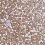 UROC1 Antibody in Immunohistochemistry (Paraffin) (IHC (P))