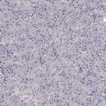 UROC1 Antibody in Immunohistochemistry (Paraffin) (IHC (P))