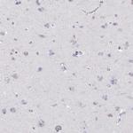 RGS19 Antibody in Immunohistochemistry (Paraffin) (IHC (P))