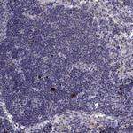 RGS19 Antibody in Immunohistochemistry (Paraffin) (IHC (P))