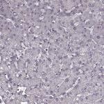 CD28 Antibody in Immunohistochemistry (Paraffin) (IHC (P))