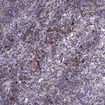 CD28 Antibody in Immunohistochemistry (Paraffin) (IHC (P))