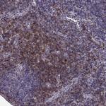 CD28 Antibody in Immunohistochemistry (Paraffin) (IHC (P))